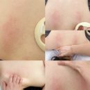 아리엘뷰티 | 팔달구 피부관리 샵 아리엘뷰티에스테틱 에서 등관리 60분 받은 후기