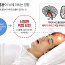 천안수면센타