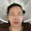 성복2로 | 성복역 두피관리 [애몽스킨케어]에서 프리미엄 두피 케어 받은 후기