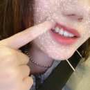 강남미라인치과의원 | 강남미라인치과 투스젬 후기! 😬✨ 가격, 부작용, 제거방법