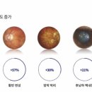 렌즈케어안경원 이미지