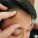 셀의원 | 피치셀의원 코어톡스 내돈내산 후기글.