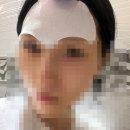 티존 | 미간주름패치로 관리하는 이마 탄력 루틴, 티존에이지패치 사용 후기
