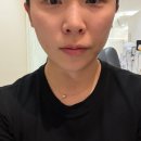 신통방통의원 | 송도피부과 올리디아 콜라겐스킨부스터 결혼 전 시술 후기(내돈내산, 옆볼꺼짐, 전후비교, 가격)