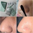 블랙헤드 없애는 법 코팩추천 및 사용법 이즈앤트리 머크워트 카밍클리어 코팩 사용후기