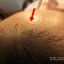 킴스헤어라인 이미지