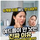 메타커넥트랩스 | 6개월 치료해도 여드름 안 낫는 진짜 이유, 피부과 전문의 조언으로 바꾼 루틴 후기