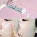 바른약국 | 약국템 재생크림 더마그램 PDRN 크림 후기 + 리쥬비넥스와 사용감 차이 비교