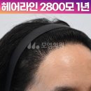 헤어라인 이미지
