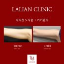 라리안 이미지