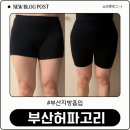 지이라인주 | 부산허벅지지방흡입 골반지방이식 2주차 후기 (출근,통증,붓기,흉터,멍,압박복,라인변화,필수 준비물)