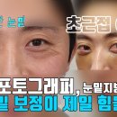 남자 눈밑지방재배치 캠, 눈밑 보정 안해도 되는 방법! 이미지