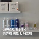 연메디칼 | 학익동피부관리 : 연에스테틱 등관리 솔직후기