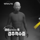 [1005회] 생로병사의 비밀/[마비를 부르는 목, 경추척수증] 젓가락으로 집은 반찬을 자꾸 떨어뜨린다. 글씨는 쓰는데 손에 힘이... 이미지