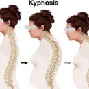 후필라테스 & 피티 이미지