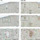 뉴타입의원 | 수유피부과, 전문의가 들려주는 솔직한 울쎄라 이야기