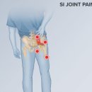 수택동사거리 현주Ifriend빌딩 앞 | 아파요..! 강직성척추염 (Ankylosing spondylitis) 에 대하여, 구리수택동사거리 정형외과 재활의학과
