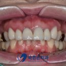 바른손치과기공소 이미지