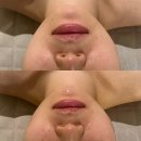 레오아 에스테틱