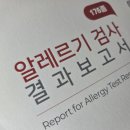 176 | 176종 알레르기 마스트검사 후기