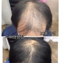 규베스 | 광주 수완지구 두피관리 ‘규베스’ 방문후기