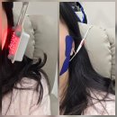 미드림치과교정과치주과치과의원 | 경기광주 턱관절 턱디스크 오페라치과의원 스플린트 가격