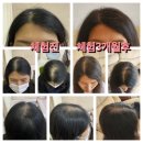정환 | 동명정환 3개월 복용 후기 ^^