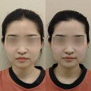 네임드테라피 | 신사피부관리 신사웨딩관리 :: 약손명가 신사역점 K-BEAUTY 연예인관리 A 솔직 후기