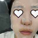 청주피부과 | 청주피부관리 “바로그의원” 내돈내산 솔직후기 재방문의사 ...음?