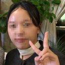 파동한의원 | 분당안면비대칭교정한의원 가격까지 좋았던 턱관절 교정 후기!!