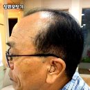 스마트보청기할인매장