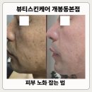 개봉1동 주민센터 | [뷰티스킨케어 개봉동본점] 피부노화 잡는 법 - 구로구 개봉동 리프팅 후기