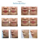 리프업의원 이미지