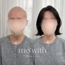 모위드 | 부산항암가발 | 자연스러운 단발 스타일 모위드가발 착용 후기