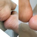 포일로 | 여름맞이 내손동발각질 관리 율빛네일 오로지푸스 후기
