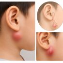 동해동인병원자판기 | [쌍둥이육아일기] 인하대병원 입원후기2 - 새열낭종 / 소아병동소개