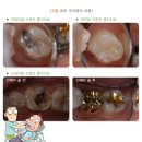 앞선치과기공소 이미지