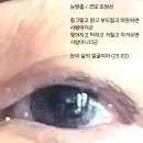 눈맞춤 티스토리