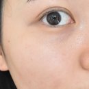 투루케어 이미지