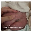 동탄 웰봄 병원 신생아 딤플 초음파 후기, 준비부터 과정까지