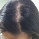 열감을 줄여주는 시오리스 밸런스 마이스칼프 샴푸! 민감성 두피에 추천해요🥰 약산성샴푸 헤어케어 추천