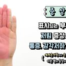 여성에게 더 많다는 손목터널증후군 자가진단 및 예방운동 이미지