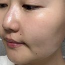 메디필 멜라논 엑스 앰플 클렌저 150ml 후기