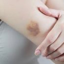 봄꽃한의원 이미지