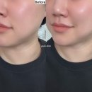 (주)데코비젼 부산지점 | 동래피부관리 찾다가 명륜동에스테틱 닥터파우제에서 윤곽관리 받고 턱선 달라진 후기