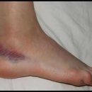 새롬한의원 이미지