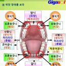 위장 장애 이미지