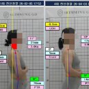 눈길에 두 번 넘어지고 3년 뒤에야 알게 된 것 | 광주 50대 최OO님 자세 관리 체험기