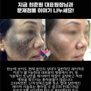 강화도 루비 이미지