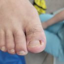 빛나러오소 문제성 발관리 계양구청점 이미지